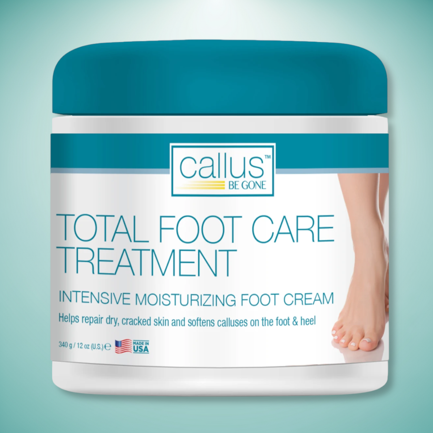 Callus Be Gone Total Foot Care Cream Treatment 12 Ounces